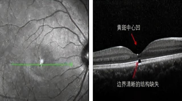 激光防護(激光個人防護措施)  第3張